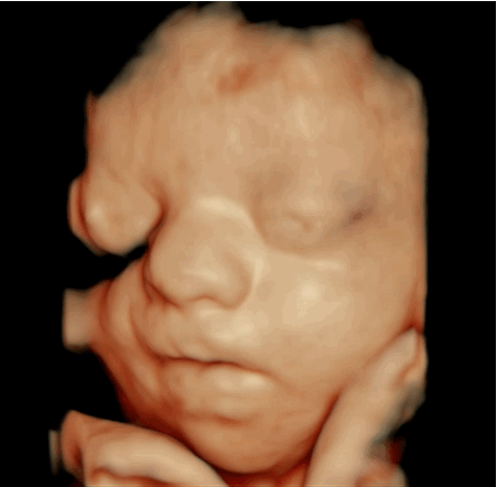 A real-time 4D ultrasound GIF of a baby’s face